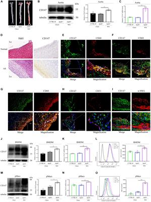 Blockade of Macrophage CD147 Protects Against Foam Cell Formation in Atherosclerosis